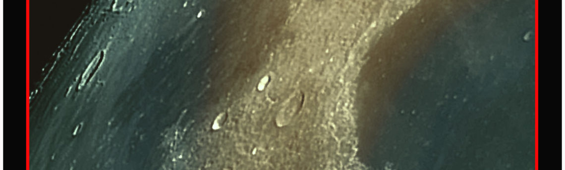 #Sinus Iridum